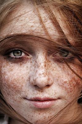 Freckles are fucking sexy